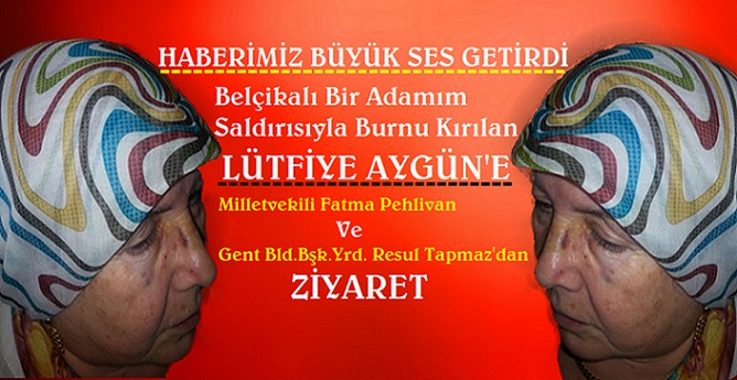 Belçikalı Bir Adamın Saldırısıyla Burnu Kırılan Lütfiye Aygün’e Pehlivan Ve Tapmaz’dan Ziyaret