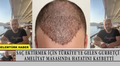 Türkiye’ye saç ektirmek için gelen gurbetçi genç, ameliyat masasında öldü