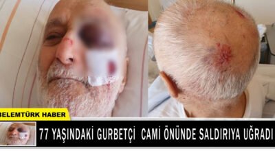 77 yaşındaki gurbetçi Mustafa Akçay cami önünde saldırıya uğradı.