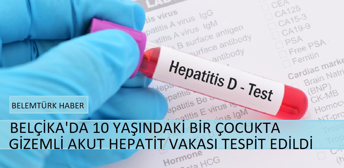 Belçika’da bir çocukta  ilk gizemli akut hepatit vakası  tespit edildi.