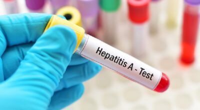 İngiltere’de “gizemli hepatit” vakalarında artış.