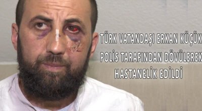 Türk vatandaşı Erkan Küçük polis tarafından dövülerek hastanelik edildi.
