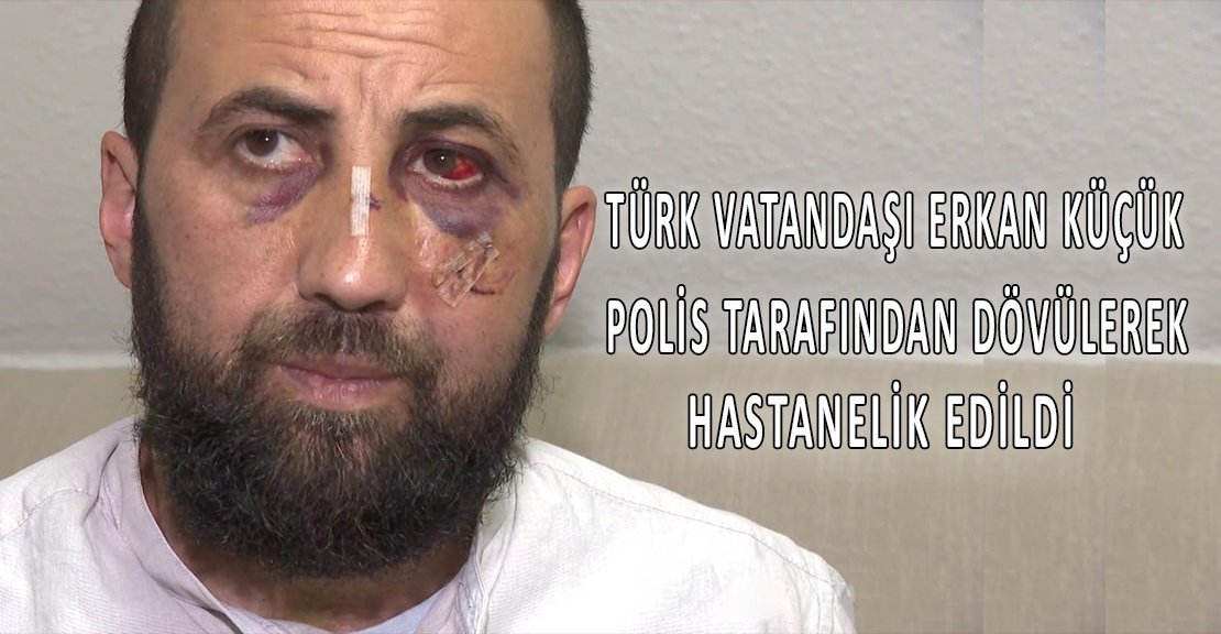 Türk vatandaşı Erkan Küçük polis tarafından dövülerek hastanelik edildi.