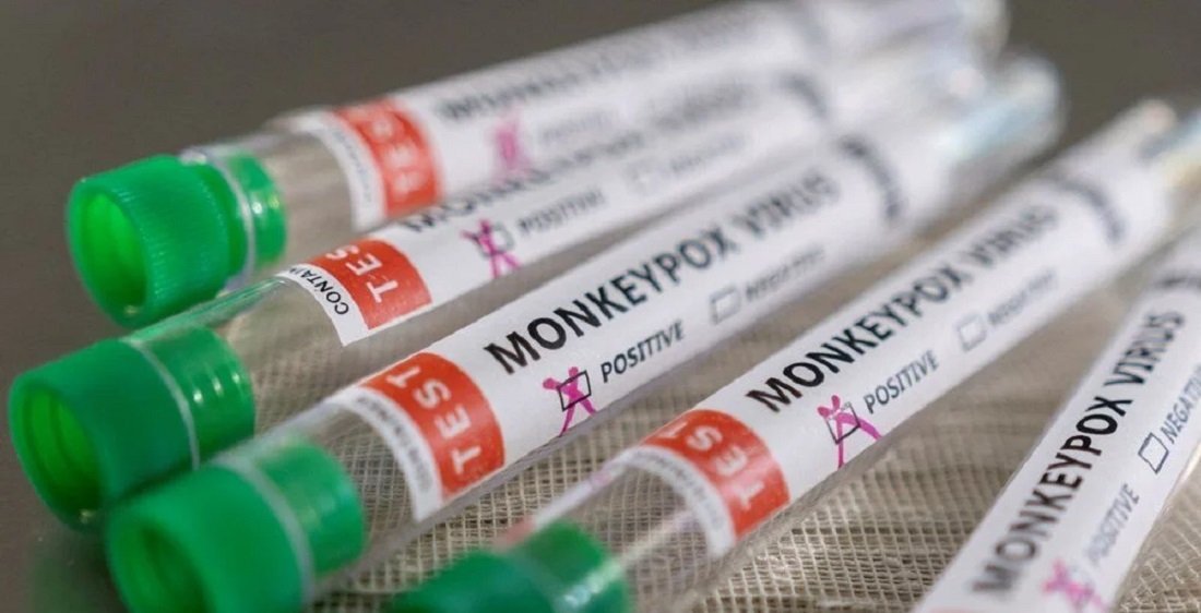 Belçika’da maymun çiçeği virüsü artmaya devam ediyor