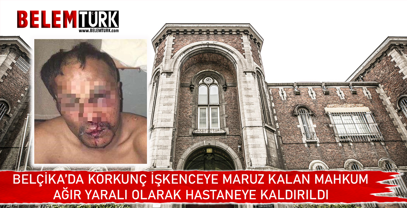 Belçika’da 3 gün boyunca korkunç işkenceye maruz kalan mahkum hastaneye kaldırıldı