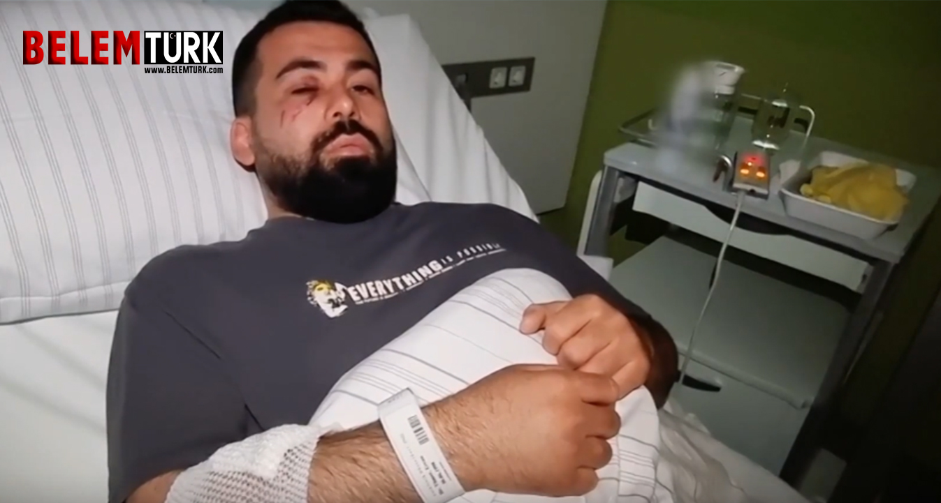 Polis şiddeti bir Türk’ü hastanelik etti : İsim benzerliği nedeniyle canından oluyordu