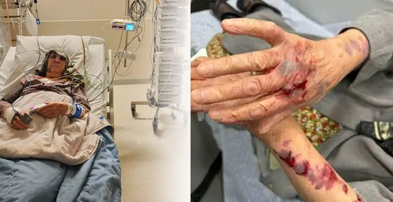 Irkçı komşusu tarafından dövülen 82 yaşındaki Türk kadın hastanelik oldu