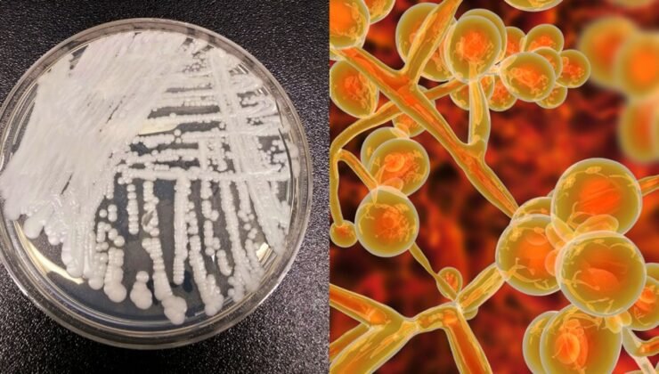 Avrupa hastanelerinde alarm : ölümcül mantar enfeksiyonu hızla yayılıyor