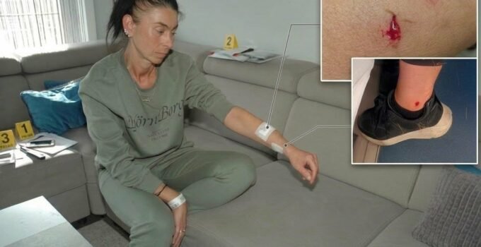 Belçika’da Türk kadını Melek Özdemir, yürüyüş yaptığı sırada polis köpeğinin saldırısına uğradı.