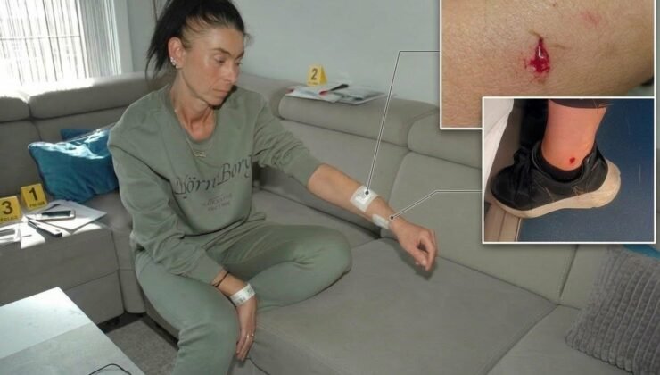 Belçika’da Türk kadını Melek Özdemir, yürüyüş yaptığı sırada polis köpeğinin saldırısına uğradı.
