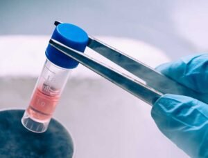 Belçika İlaç Ajansı Türkiye’deki kök hücre tedavilerine karşı uyardı